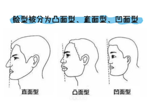 牙齿矫正真的会让面型变好看吗？