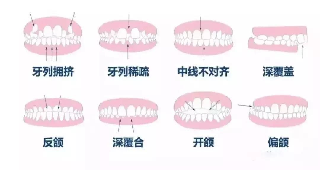 同样是牙齿矫正，为什么价格不一样？