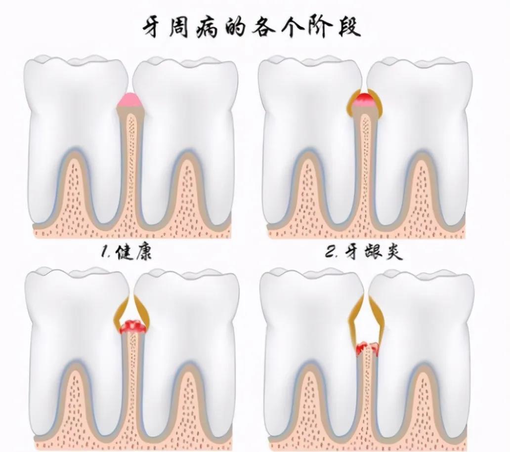 你的口腔是否健康？教你8个自检小秘诀！