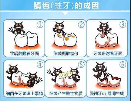 及时补牙其实能帮你省很多钱哦～