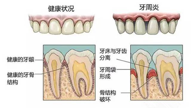 原来塞牙也是一种病？