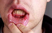 常见的口腔疾病有哪些，如何预防口腔疾病？
