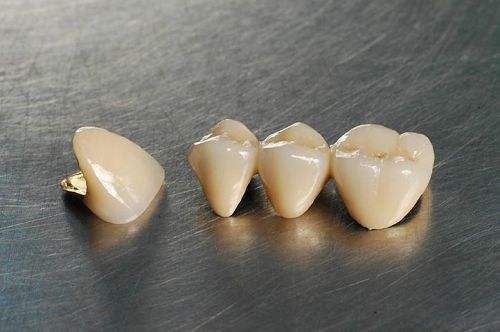 做烤瓷牙多少钱一颗？