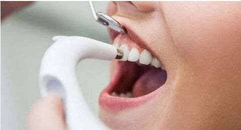 推荐：牙疼的原因？