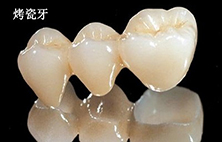 牙齿不齐做烤瓷牙好不好？
