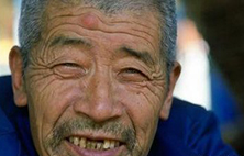 牙周炎是口腔健康的头号杀手！