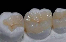 补牙材料什么样的性质，种类，哪个比较好？