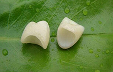 牙周病能不能做烤瓷牙？