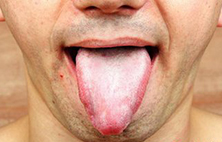 想知道口腔溃疡的原因吗？