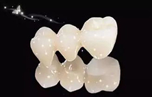 全瓷牙和烤瓷牙有何不同？全瓷牙又有哪些优点？
