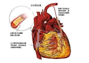 牙周炎.jpg