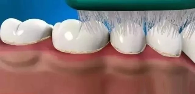 洗牙.jpg